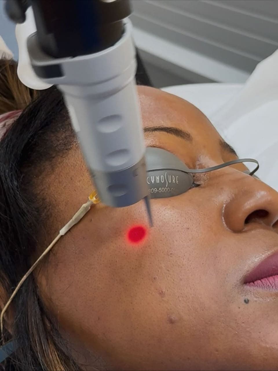 Laser, energy and skin remodeling at Arziki Aesthetics