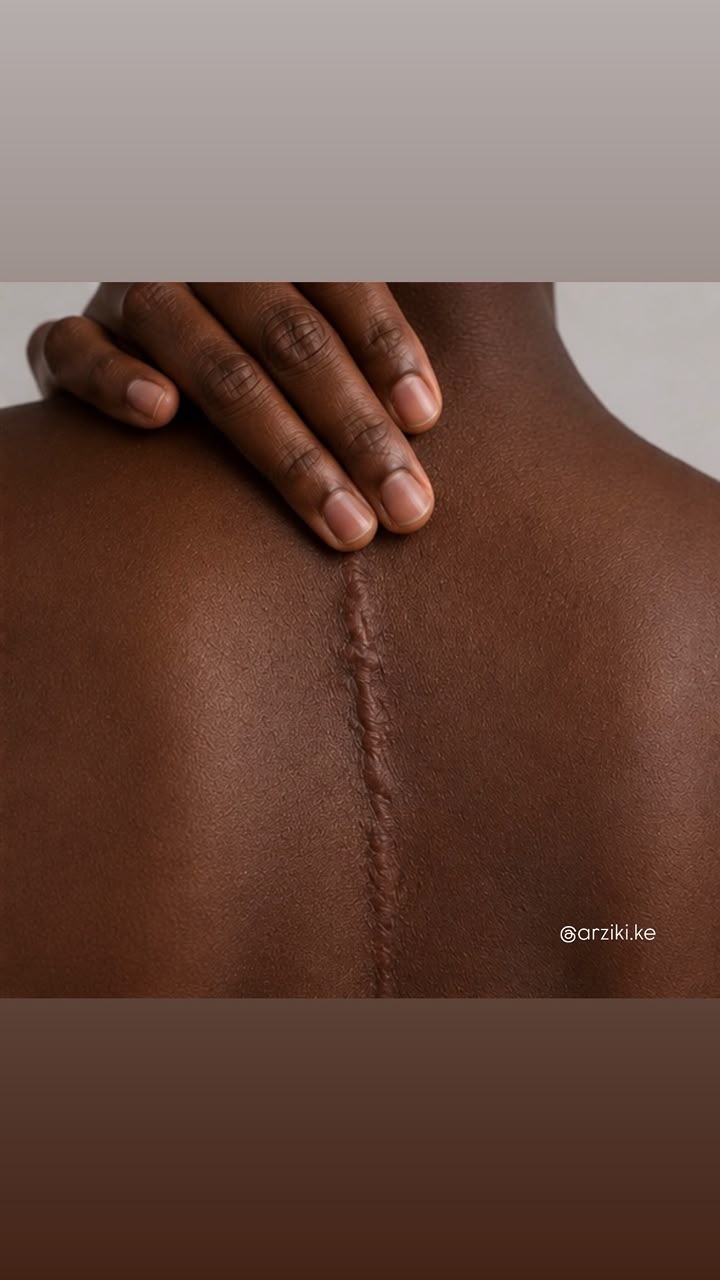Scar remodeling at Arziki Aesthetics