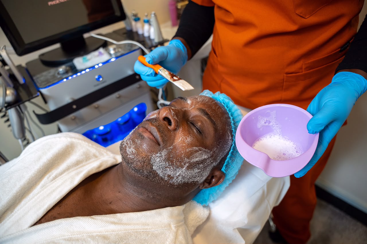 Advanced depigmenting peel at Arziki Aesthetics